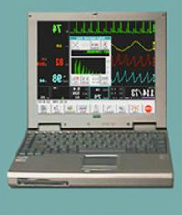 Монитор пациента МАРГ 10-01 (На базе ноутбука)