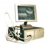 Ультразвуковой сканер- приставка ВЕТЕРИНАР с электронным датчиком