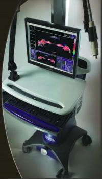 Ультразвуковой биомикроскоп Sonomed VuMax II