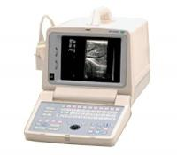 Ультразвуковой сканер CHISON 500J